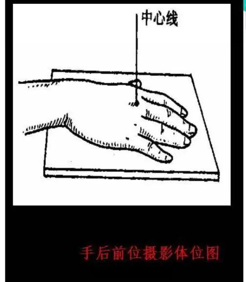 X线摄影技术完整收藏篇——工作必备