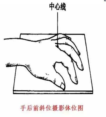 X线摄影技术完整收藏篇——工作必备