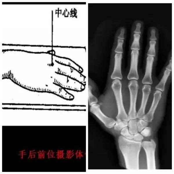 X线摄影技术完整收藏篇——工作必备
