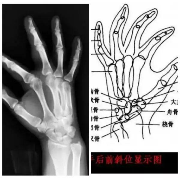 X线摄影技术完整收藏篇——工作必备