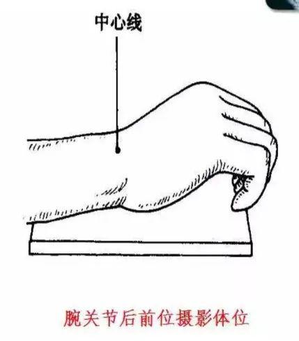 X线摄影技术完整收藏篇——工作必备