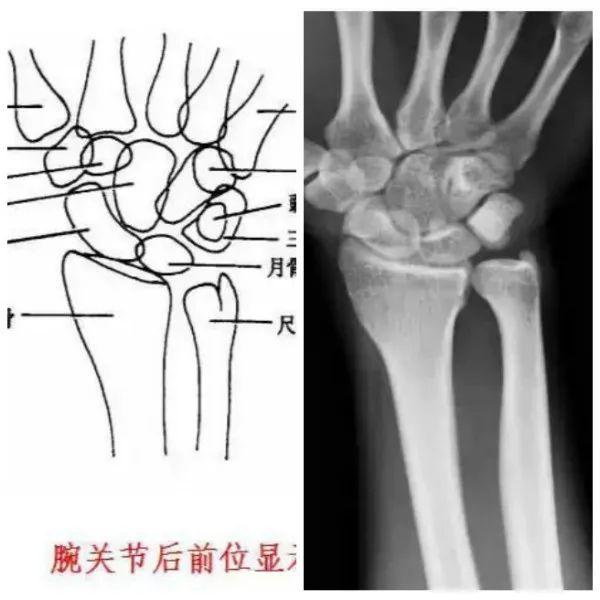 X线摄影技术完整收藏篇——工作必备