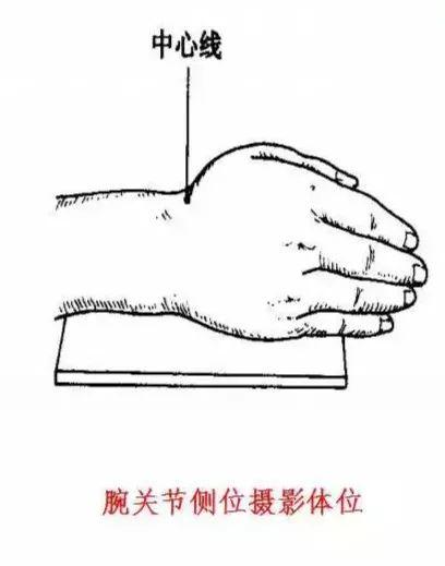 X线摄影技术完整收藏篇——工作必备