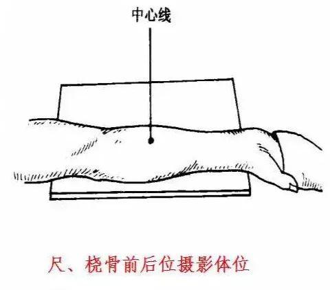 X线摄影技术完整收藏篇——工作必备
