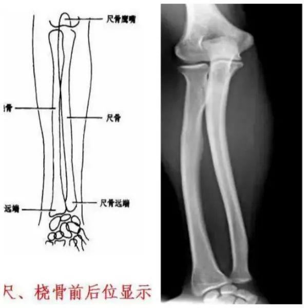 X线摄影技术完整收藏篇——工作必备