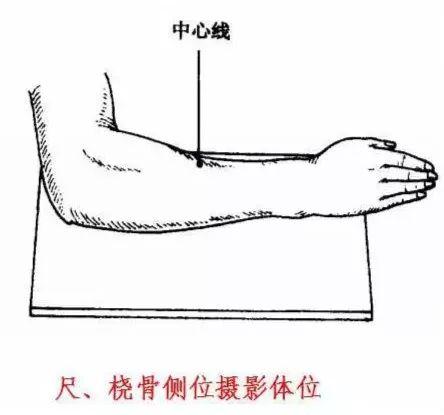 X线摄影技术完整收藏篇——工作必备