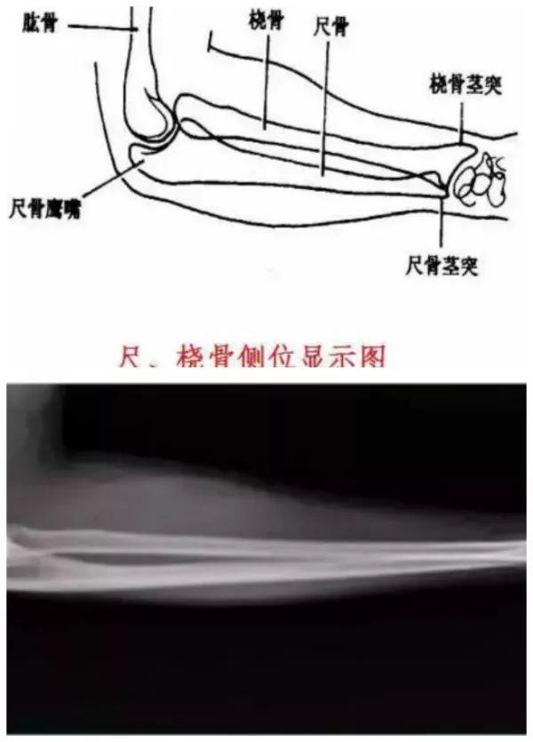 X线摄影技术完整收藏篇——工作必备