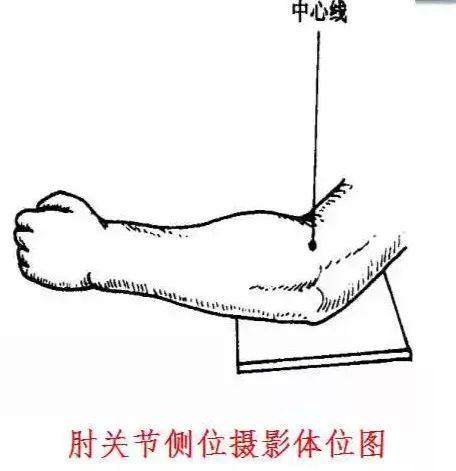 X线摄影技术完整收藏篇——工作必备