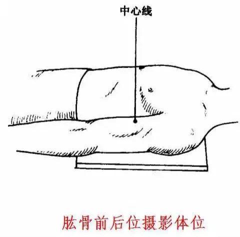 X线摄影技术完整收藏篇——工作必备