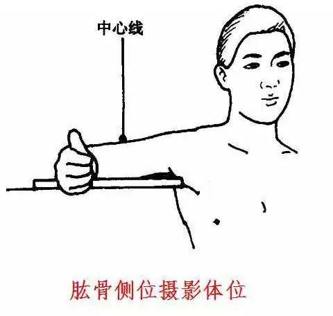 X线摄影技术完整收藏篇——工作必备
