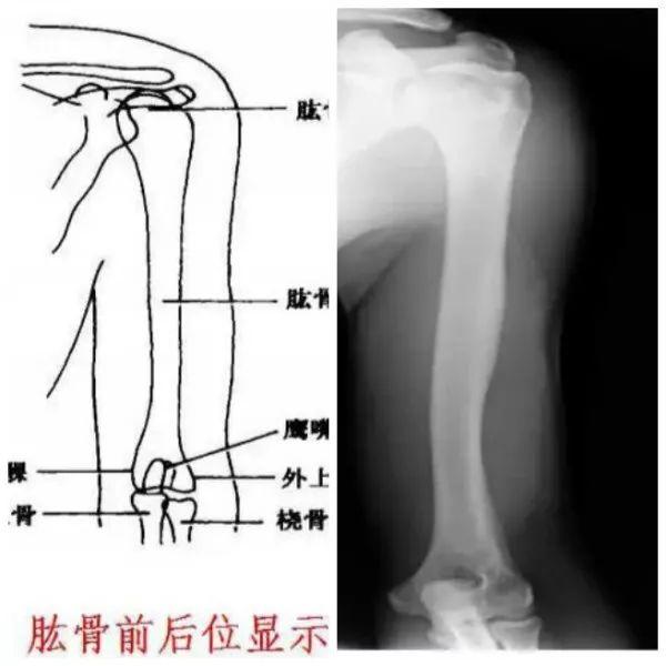 X线摄影技术完整收藏篇——工作必备