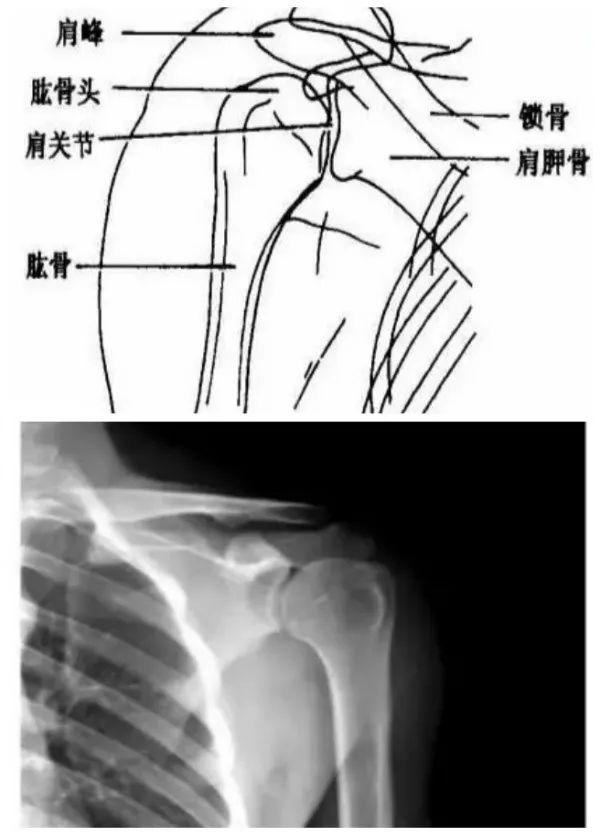 X线摄影技术完整收藏篇——工作必备