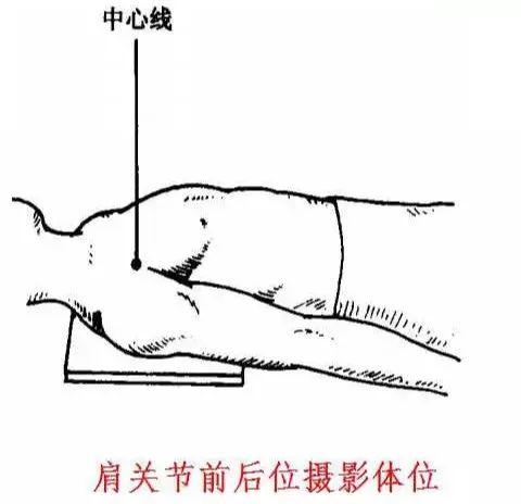 X线摄影技术完整收藏篇——工作必备