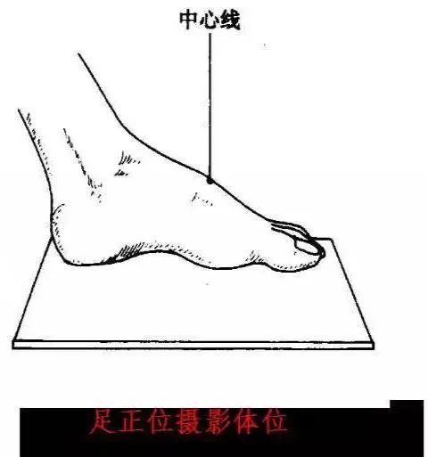 X线摄影技术完整收藏篇——工作必备