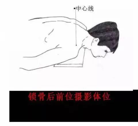 X线摄影技术完整收藏篇——工作必备