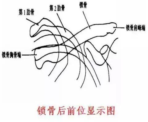 X线摄影技术完整收藏篇——工作必备
