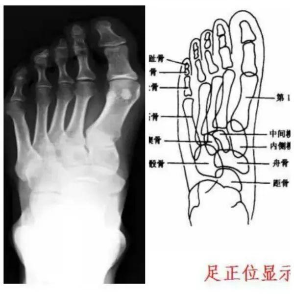X线摄影技术完整收藏篇——工作必备