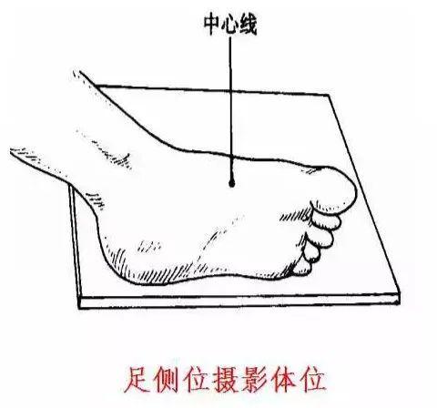X线摄影技术完整收藏篇——工作必备