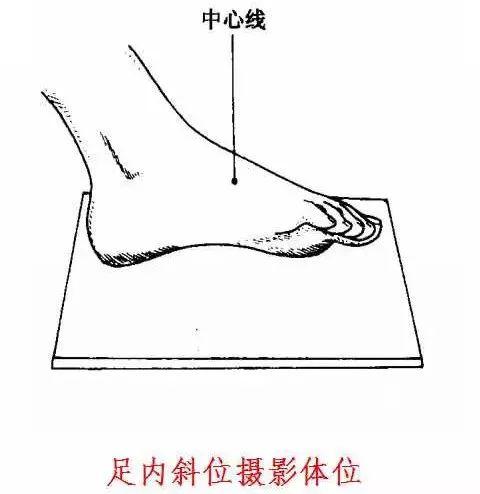 X线摄影技术完整收藏篇——工作必备