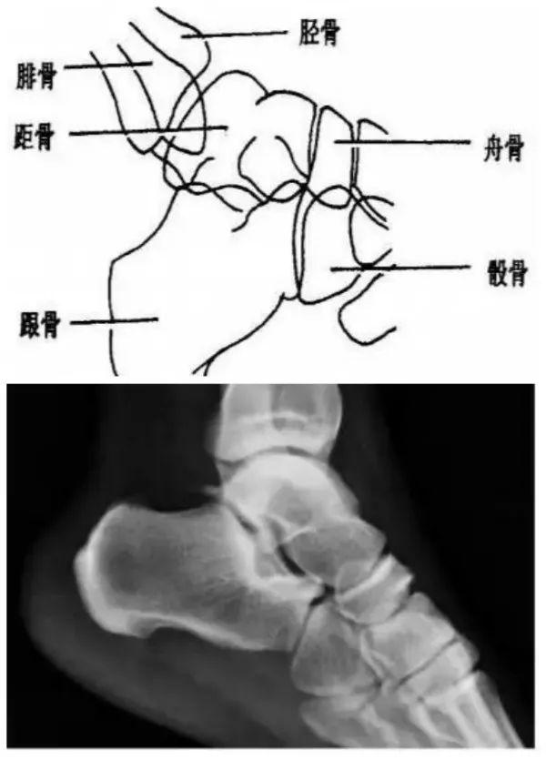 X线摄影技术完整收藏篇——工作必备