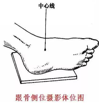 X线摄影技术完整收藏篇——工作必备