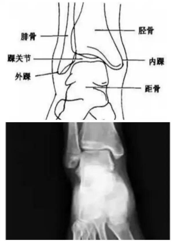 X线摄影技术完整收藏篇——工作必备