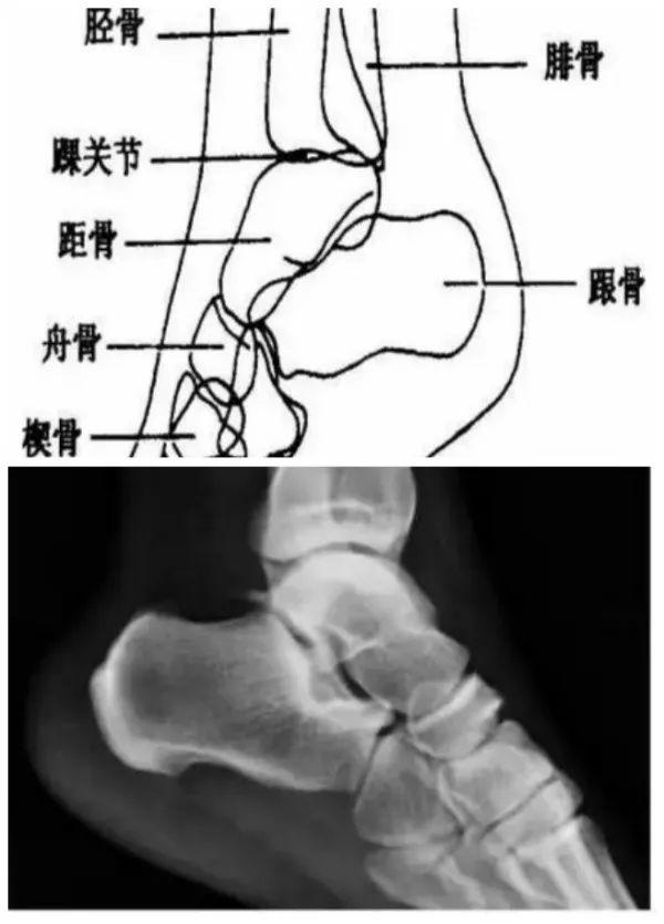 X线摄影技术完整收藏篇——工作必备