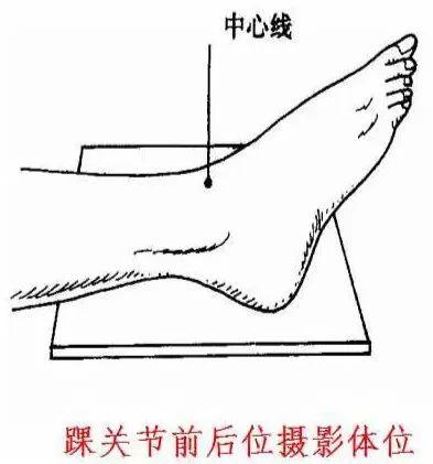 X线摄影技术完整收藏篇——工作必备