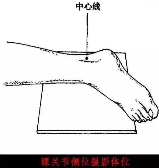 X线摄影技术完整收藏篇——工作必备