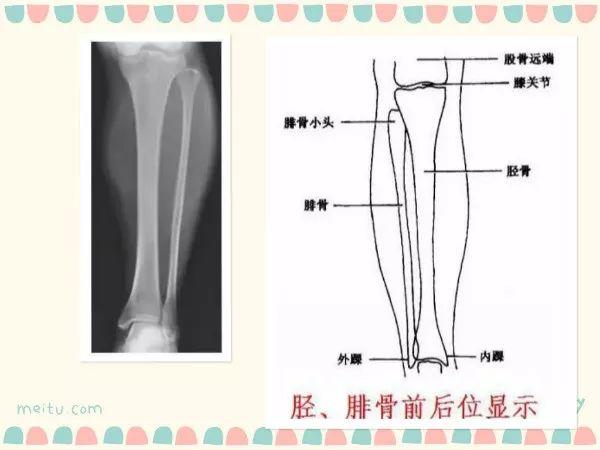 X线摄影技术完整收藏篇——工作必备