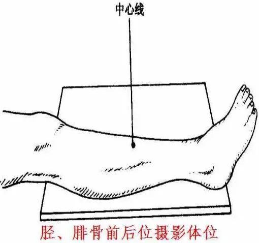 X线摄影技术完整收藏篇——工作必备