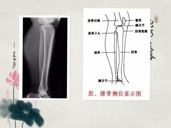 X线摄影技术完整收藏篇——工作必备
