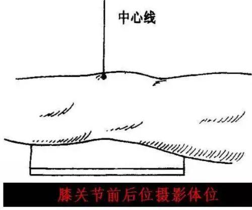 X线摄影技术完整收藏篇——工作必备