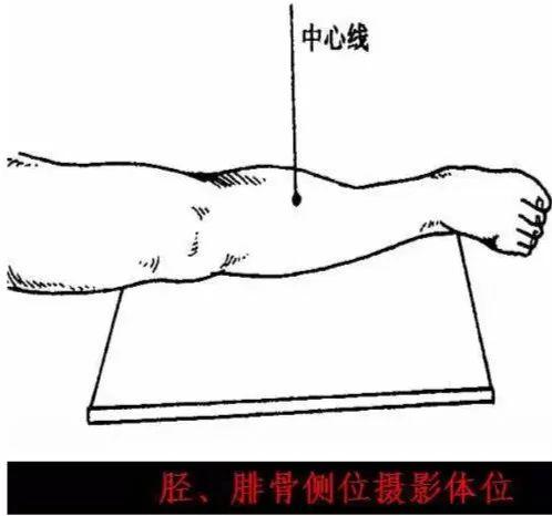 X线摄影技术完整收藏篇——工作必备