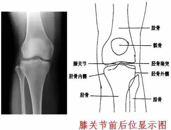 X线摄影技术完整收藏篇——工作必备