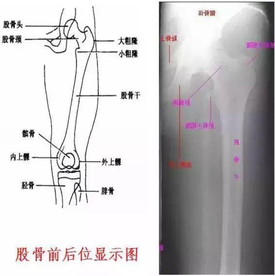 X线摄影技术完整收藏篇——工作必备