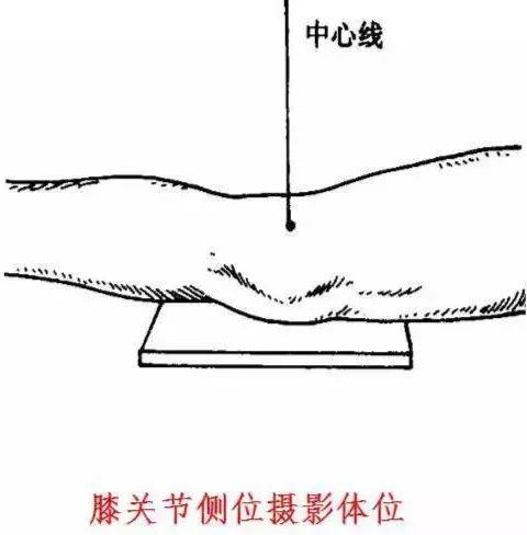 X线摄影技术完整收藏篇——工作必备