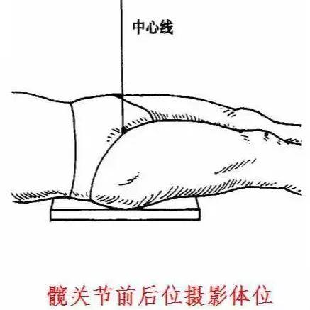X线摄影技术完整收藏篇——工作必备