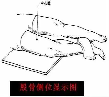 X线摄影技术完整收藏篇——工作必备