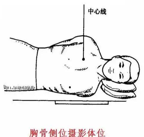 X线摄影技术完整收藏篇——工作必备