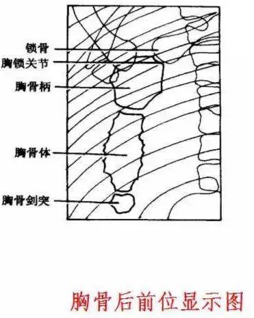 X线摄影技术完整收藏篇——工作必备