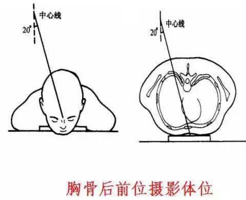 X线摄影技术完整收藏篇——工作必备